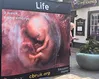 Pro-life Keswick campaigners say activities 'misreported' to Convention