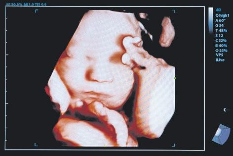 US moves to protect unborn children