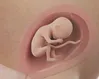 One in three pregnancies aborted? It’s ‘devastating’